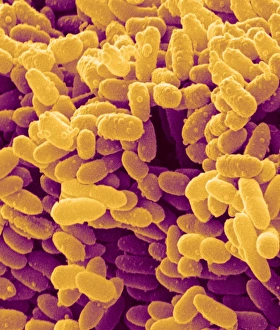 Images Dated 25th June 2004: SEM Print of Erwinia bacteria