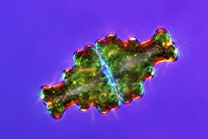 Polarised Light Microscopy Prints: Euastrum desmids, light micrograph