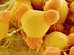 Pollen Grain Structure Prints: Evening primrose pollen, SEM