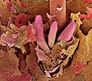 Eyelash mite tails, SEM Eyelash mite tails, SEM