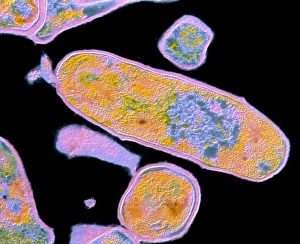 F/col TEM of Corynebacterium diphtheria F/col TEM of Corynebacterium diphtheria