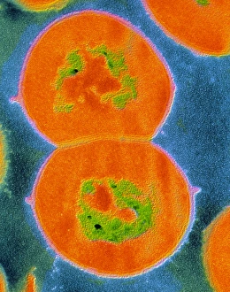 Prints of F/col TEM of Streptococcus viridans Images Dated 2003 January: Streptococcus viridans TEM Print