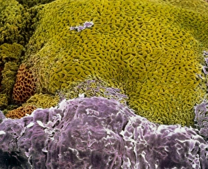 F/colour SEM of oesophagus-stomach transition zone F/colour SEM of oesophagus-stomach transition zone