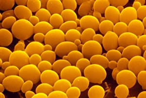 False-col SEM of yeast cells False-col SEM of yeast cells
