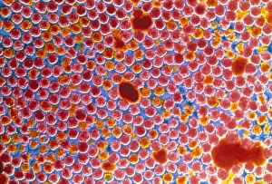 False-col TEM of polio virus particles False-col TEM of polio virus particles