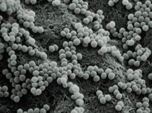 Staphylococcus Aureus Bacteria Prints: False-col TEM of Staphylococcus aureus