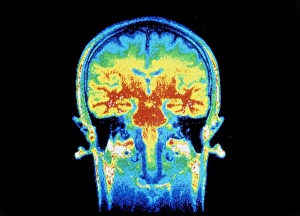 False-colour NMR scan of the head, frontal section False-colour NMR scan of the head, frontal section