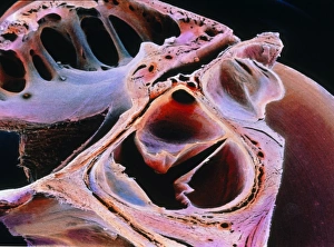 False-colour SEM of the aortic valve False-colour SEM of the aortic valve