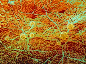 Images Dated 1988: False-colour SEM print of bread mould with hyphae and sporangia