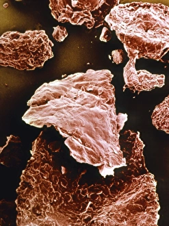 Human Skin Anatomy Prints: False-colour SEM of dandruff