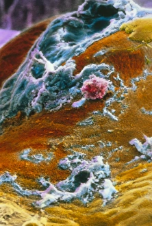 False-colour SEM of human egg after ovulation False-colour SEM of human egg after ovulation