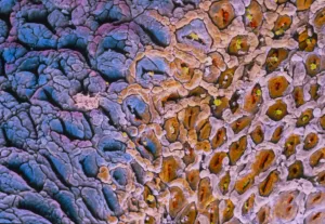 False-colour SEM of ileo-caecal junction False-colour SEM of ileo-caecal junction