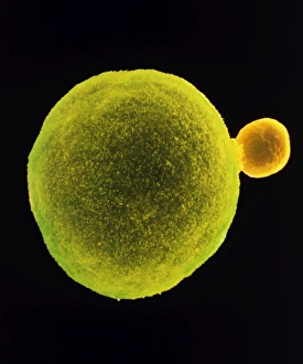False-colour SEM of secondary oocyte & polar body False-colour SEM of secondary oocyte & polar body