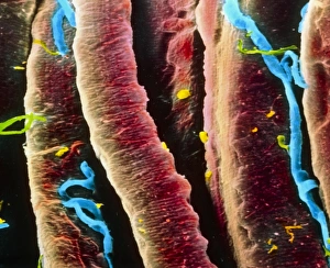 False-colour SEM of skeletal muscle fibres False-colour SEM of skeletal muscle fibres