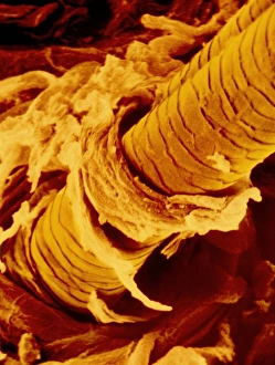 False-colour SEM of the surface of human skin False-colour SEM of the surface of human skin