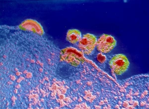 False Colour TEM Images Prints: False colour TEM of AIDS virus