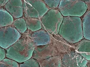 Images Dated 12th December 2001: Fat cells, SEM