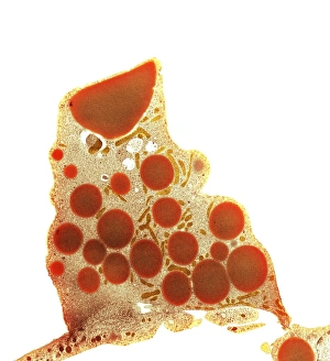 TEM Print of Adipocytes in Fat Tissue