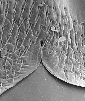 Female bedbugs abdomen, SEM Female bedbugs abdomen, SEM