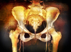 Female pelvis, coloured 3-D CT scan Female pelvis, coloured 3-D CT scan