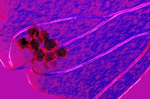 Polarised Light Micrograph Prints: Fern spore cases, light micrograph
