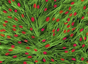 Light Micrograph Images Prints: Fibroblast cells, light micrograph