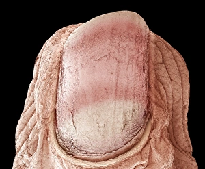 Scanning Electron Microscope Photos Prints: Fingernail, SEM