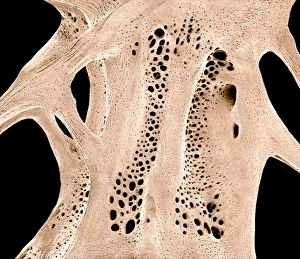 Fish bone print, SEM image