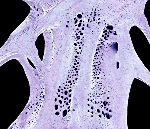 Cancellous Bone Structure Prints: Fish bone, SEM C015 / 8068
