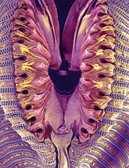 Insect Mouthparts SEM Prints: Fly proboscis, SEM