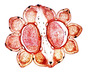 Light Microscopy Images Prints: Fools parsley fruit, light micrograph