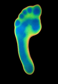 Thermography Images Prints: Foot, thermogram