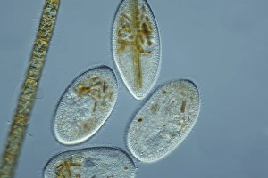 Light Micrograph Images Prints: Frontonia protozoa, light micrograph