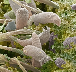 Prints of Gall mites. Coloured scanning electron micrograph (SEM) of several gall mites (Eriophyes sp.). These pests infest a wide range of plants, causing economic damage to food crops and forests Images Dated 2004 January: SEM Print of Gall Mites