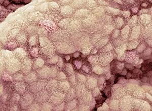 Coloured SEM Images Prints: Gallbladder surface, SEM