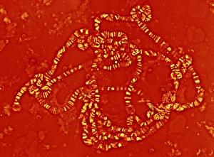 Chromosome Structure Prints: Giant chromosome, light micrograph