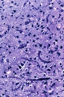 Glial cells in the brain, Print