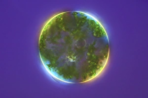 Green Alga Print, Eremosphaera viridis Light Micrograph
