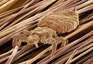 Images Dated 2000: Head Louse Print, Coloured SEM of a Blood-Sucking Insect