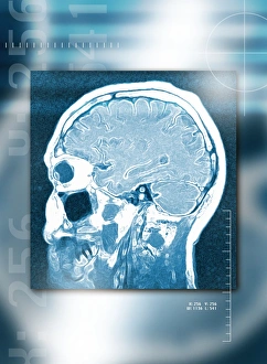 Human Brain Structure Prints: Head, side view, MRI scan