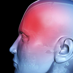 Headache Print - Computer artwork of a skull with a red headache area