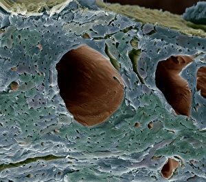 Heart blood vessels, SEM Heart blood vessels, SEM