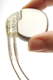 Pacemaker Print: A round device held between finger and thumb