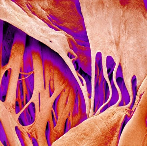 Prints of Heart valve and strings, coloured scanning electron micrograph (SEM) Images Dated 2009 May: SEM Print of Mitral Valve and Chordae Tendineae