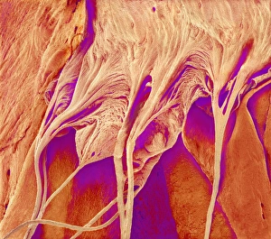 Tricuspid Valve and Chordae Tendineae Print