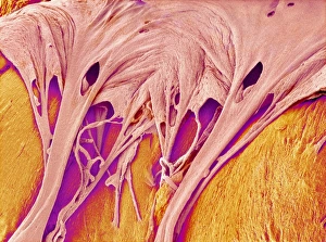 Tricuspid Valve and Chordae Tendineae Print