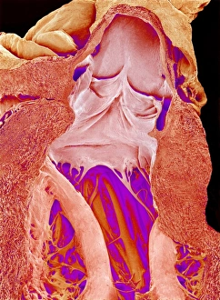 Prints of Heart valves and strings, coloured scanning electron micrograph (SEM). This dissection shows both the mitral valve (centre) and the aortic valve (upper centre) Images Dated 2009 May: Coloured SEM Print of Heart Valves and Strings