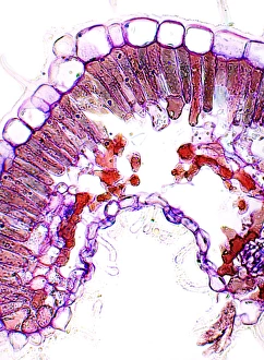 Drought Resistant Plants Prints: Heather leaf, light micrograph