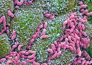 Helicobacter pylori bacteria in stomach Helicobacter pylori bacteria in stomach