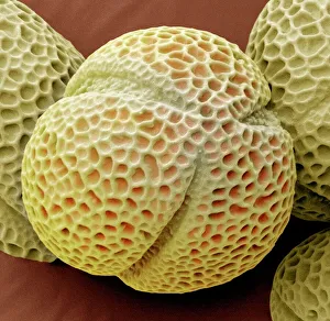 Coloured Scanning Electron Micrograph Prints: Hellebore pollen, SEM